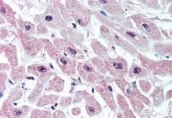 Kir3.1 Antibody, Novus Biologicals 50 &mu;g | Buy Online | Novus Biologicals | Fisher Scientific